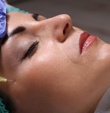 Woman leaning back for Juvederm dermal fillers in Albuquerque