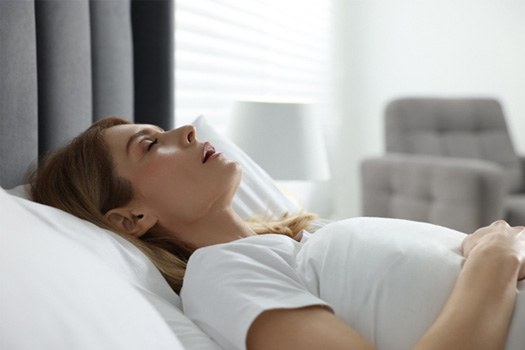 Woman in white shirt and bedding sleeping