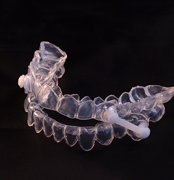 Close-up of sleep apnea oral appliance in Albuquerque, NM