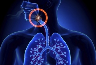 Animation of obstructed airway