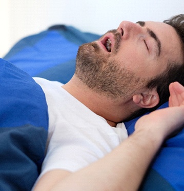 Man lying on back snoring with sleep apnea